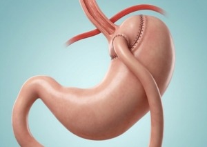 GI Surgery - Our Services - Dr. Nainesh Patel -