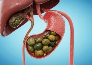 Our Services - Gallbladder Surgery - Dr. Nainesh Patel