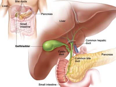 Best Gallbladder Surgeon in Surat | Gallstone Treatment | Laparoscopic Surgery