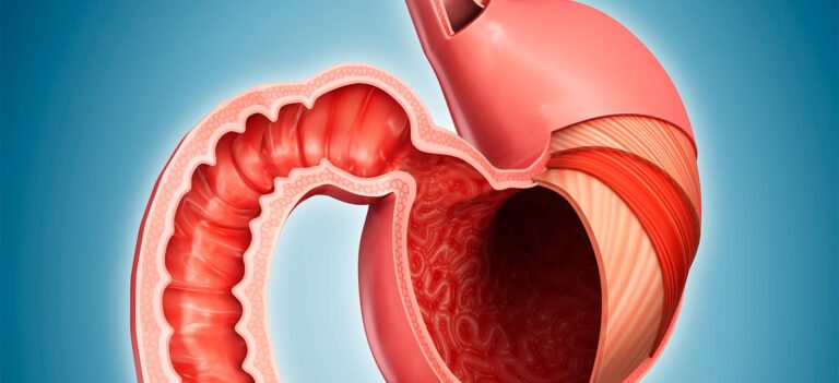 GI (Gastrointestinal) Surgery Surat